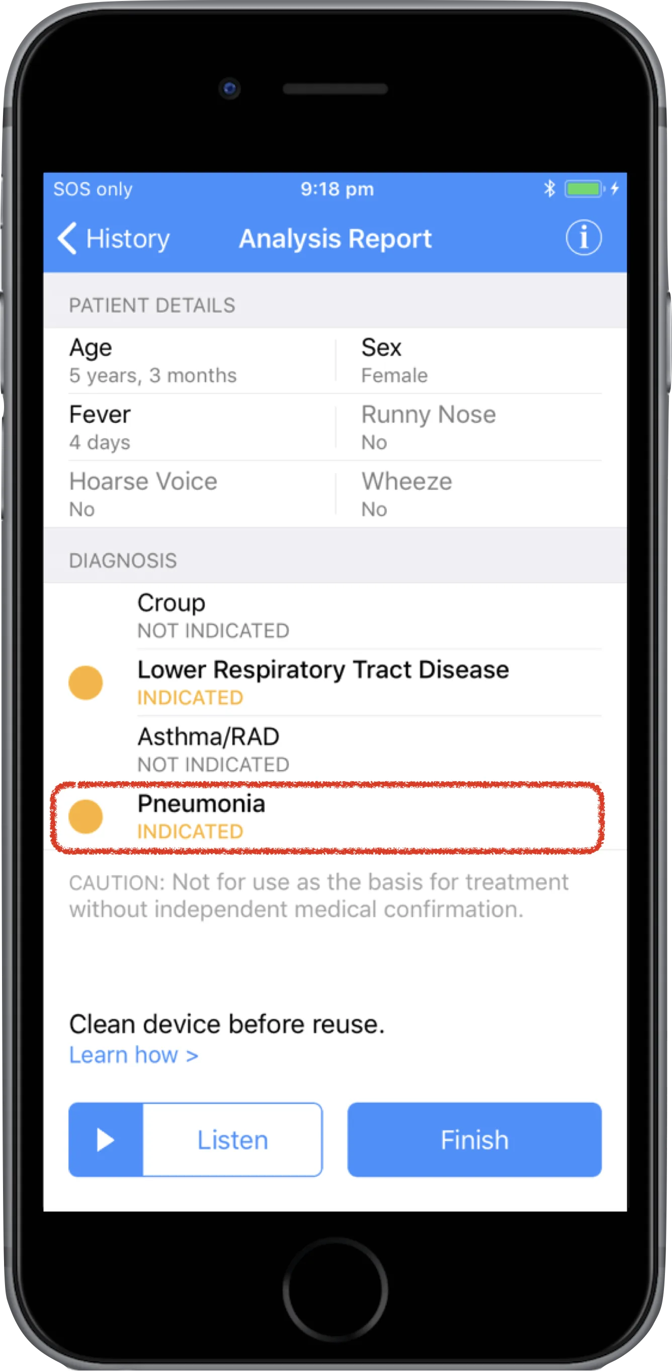Smartphone screen displaying an AI-assisted medical report