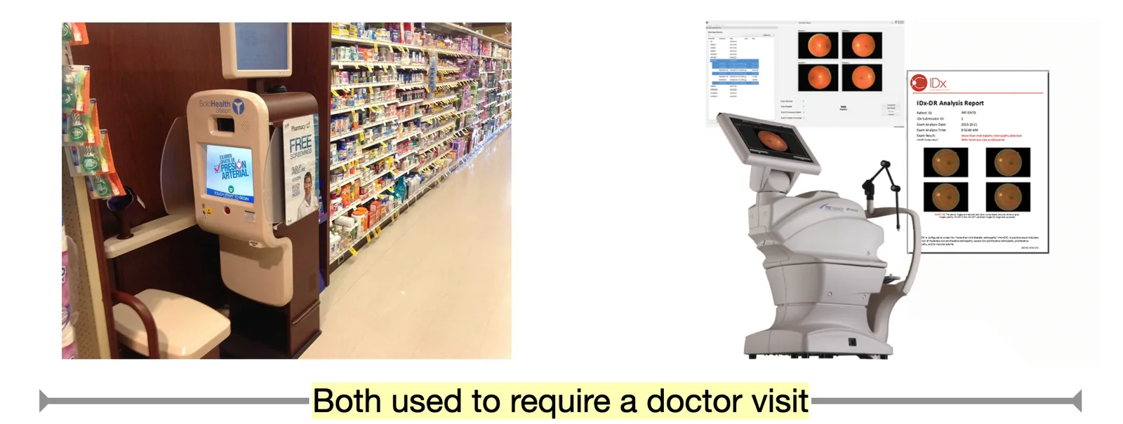 Comparison of a retail medical kiosk and automated diabetic retinopathy screening equipment